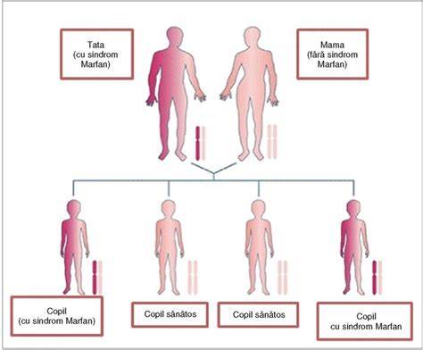 Infografic: Căi de management pentru sindromul Marfan (cauze, diagnostic, monitorizare, tratament)