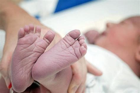 Malformații congenitale la copii