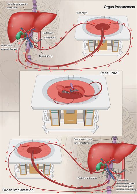 Simbol transplant hepatic