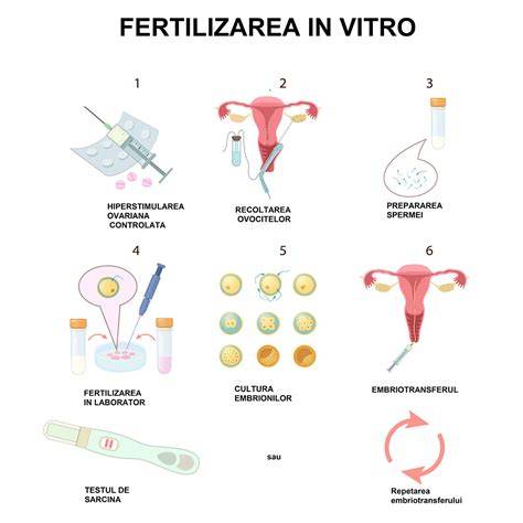 Infografic: Etapele FIV - stimulare, recoltare, fertilizare, cultură, transfer