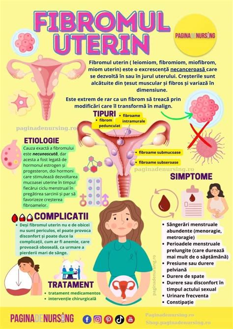 Infografic explicativ despre fibromul uterin