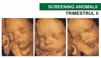 Ecografie trimestrul II - anatomie fetală