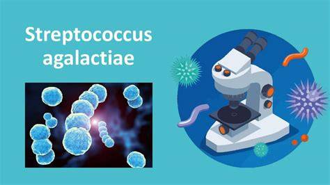 Infografic: perinatalitatea și profilaxia Streptococcus agalactiae