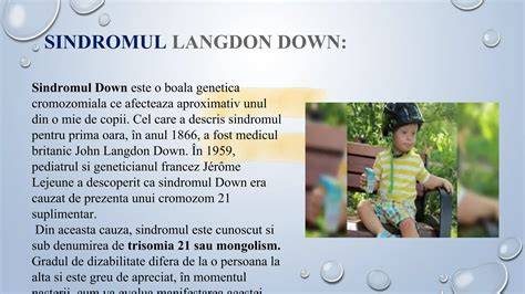 Infogramă despre tipuri de Sindrom Down și distribuția lor