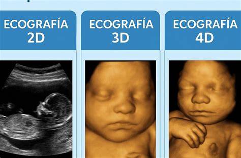 Diagrama comparației: ecografia 2D vs 4D în sarcină