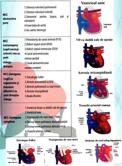 Diagrame cu defecte cardiace congenitale comune la copii