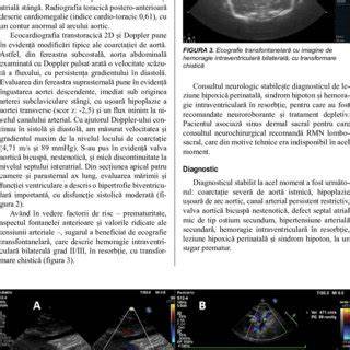 Ecocardiografie Doppler Color la copii