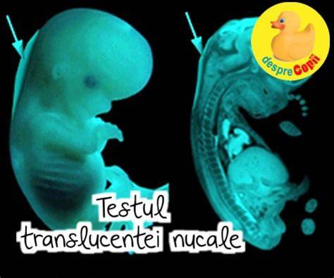 Infographic: window de screening al translucentei nucale (11-14 saptamani) si factori de risc