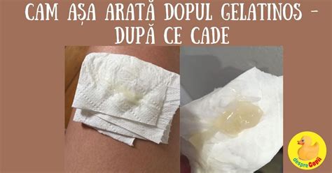 Diagrama comparativă: Dopul gelatinos și Ruperea apei