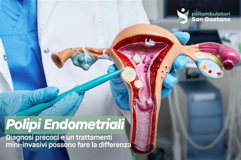 Infografic: Algoritm diagnostic polipi endometriali