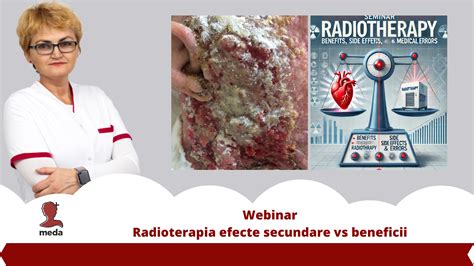 Infografic despre posibilele efecte secundare ale avortului medicamentos
