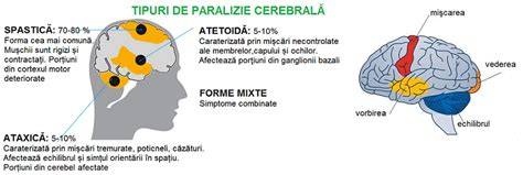 Schema de diagnostic pentru paralizie cerebrala si etapele evaluative