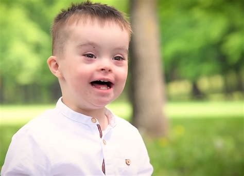 Copil cu sindrom Down zâmbind