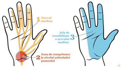Infografic: traseu nerv median prin tunelul carpian