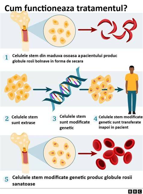 Infografic: flux de diagnostic genetic si terapie de sustinere