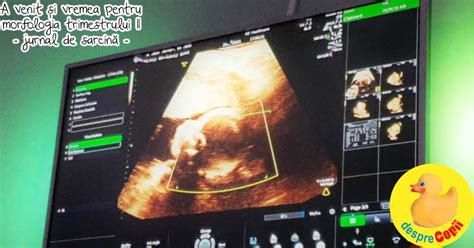 Vizualizare 3D/4D a fătului în morfologia trimestrului II