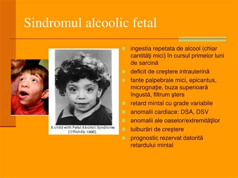 infografic despre sindromul alcoolic fetal