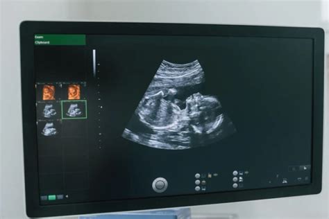 ecografie-morfologie-fetala-suceava