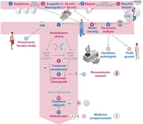 Infografic: Fluxul unui consult oncologic și opțiunile de tratament în cazul cancerului de sân