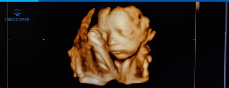 Diagrama interpretare risc Dublu Test