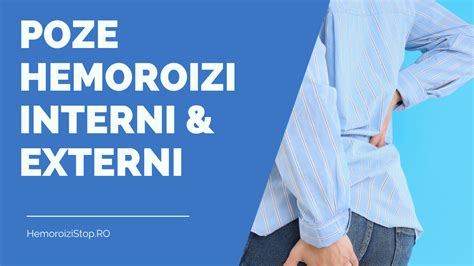 Ilustrație: Hemoroizi interni vs. externi