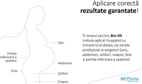 Diagramă cu zonele predispuse la vergeturi în sarcină