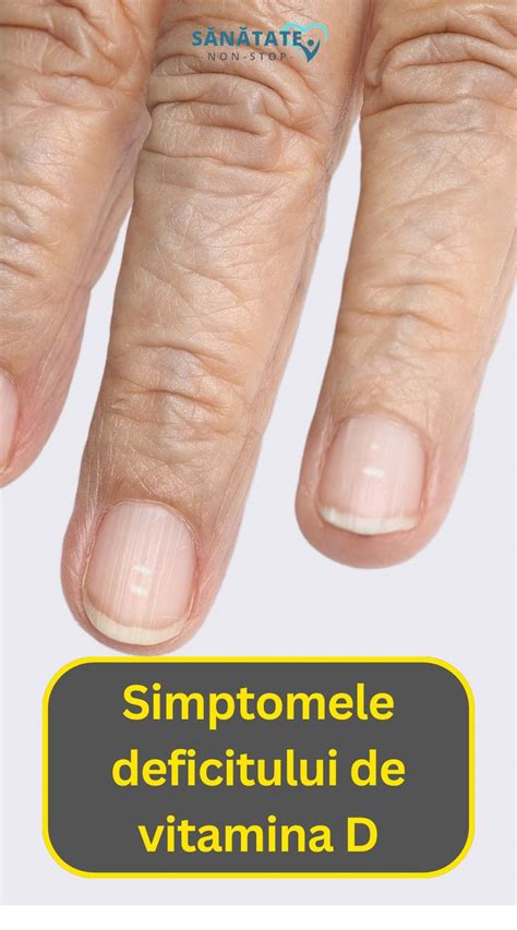 Ilustrație cu simptomele deficitului de vitamina D