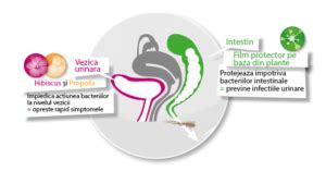 Infografic cu cauzele infecțiilor urinare