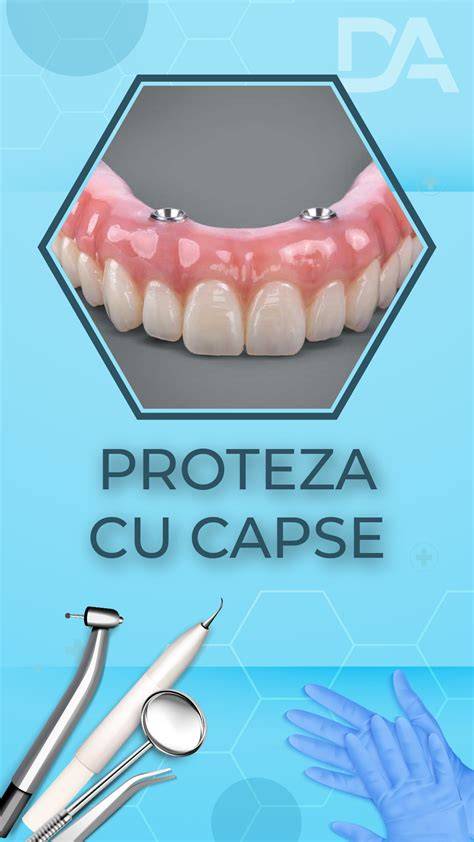 Plasare proteza intraperitoneala in fata defectului ombilical - triangulare si distante