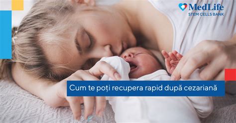 Infografic: Recuperarea după cezariană