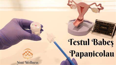 Test Babeș-Papanicolau