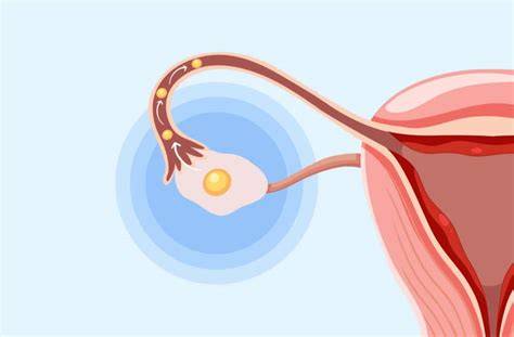 https://example.com/img/implantare-ovulation.png