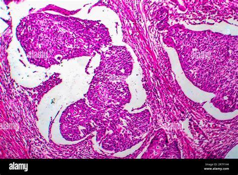 Col de uter microscopic