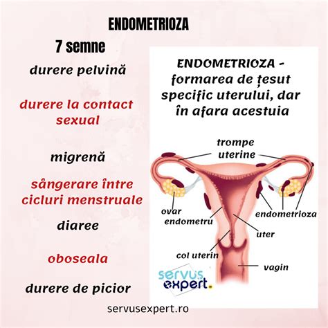 Ilustrație a cavității uterine cu endometru