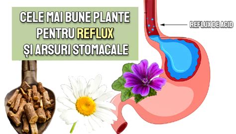 Arsuri stomacale și constipație în sarcină