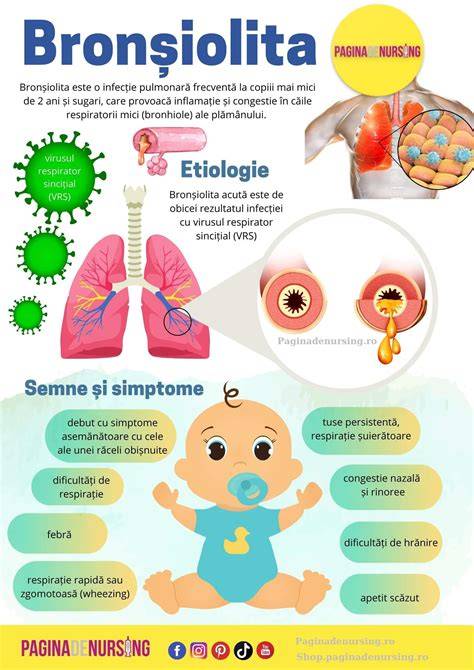 Schema tratamentului inhalator la sugari cu bronșiolită