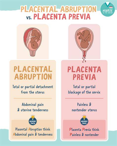 Diagrame despre poziția placentei: previa vs normal