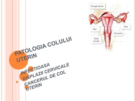 Diagrama colului uterin cu zona de tranziție