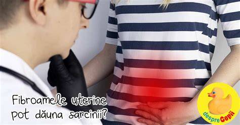 Schema: cum pot afecta fibroamele sarcina si ce optiuni de tratament exista