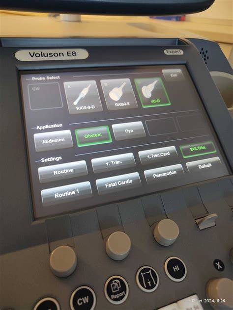 Ecograf Voluson 8 performing în Holomed