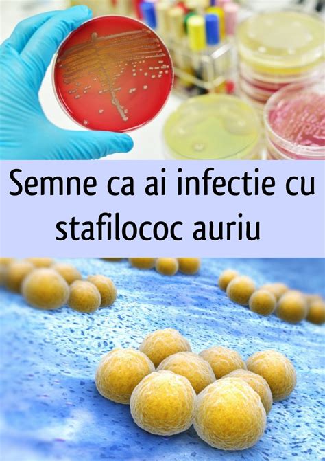 Ilustrație a diferitelor tipuri de infecții ale pielii cauzate de stafilococ auriu