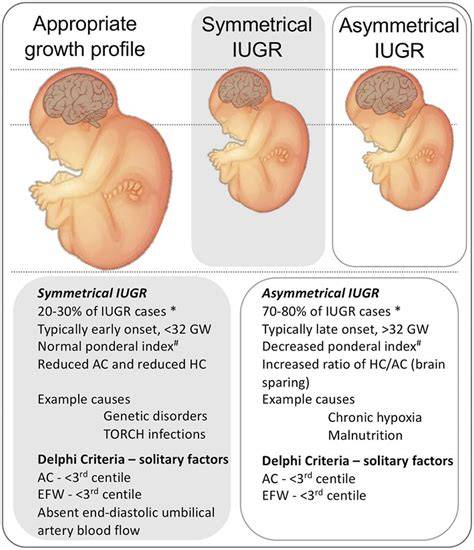 Infografic - Circuitul posibilelor mecanisme ale IUGR: placentă, flux Doppler, cortical development