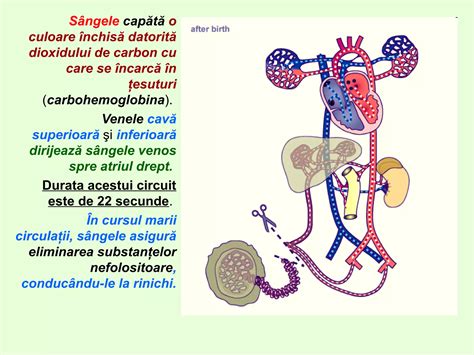 Diagramă schematică a uterului, evidențiind potențiala perforație