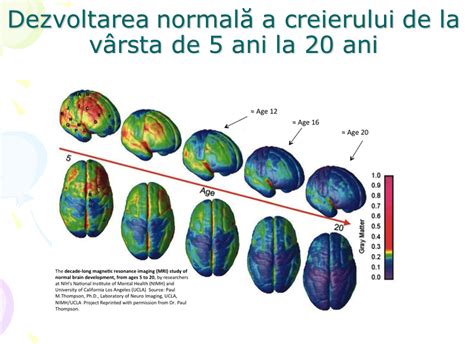 Infografic: etape de dezvoltare a creierului fetal și postnatal