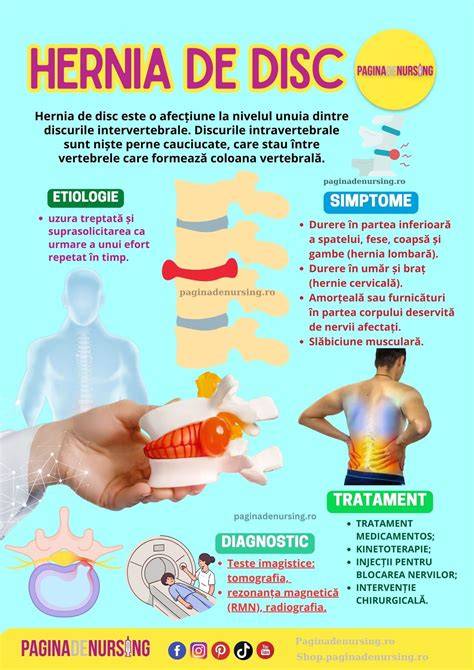 Diagrama netevine a factorilor de risc pentru hernia inghinala