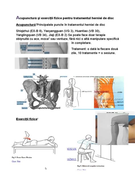 Schema fluxului de recuperare postoperator pentru hernie inghinala