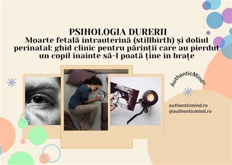 Infografic: etape ale travaliului dupa moarte fetală intrauterină