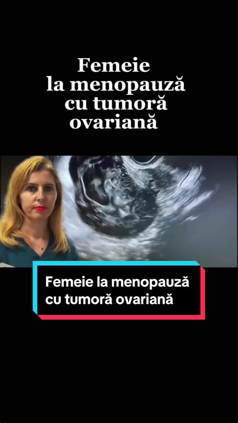 Grafic explicativ al ariilor de competență: oncoginecologie, uro-ginecologie, ecografie obstetricală și ginecologică, tratament minim invaziv