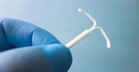 Diagrama sistemului intrauterin Mirena