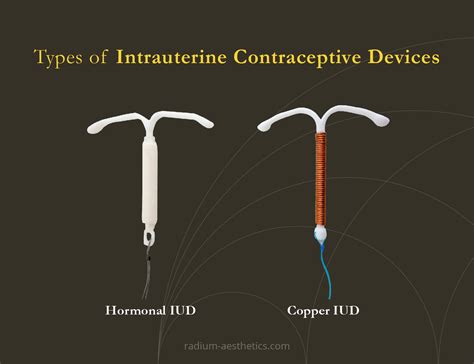 Ilustrație a diferitelor tipuri de contraceptive intrauterine